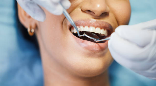 Best Broken or Cracked Tooth Emergency Dentist in Bristol, TN